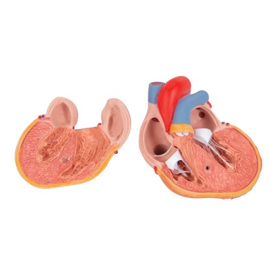 3B Scientific 2-Part Anatomical Heart Model with Left Ventricular Hypertrophy